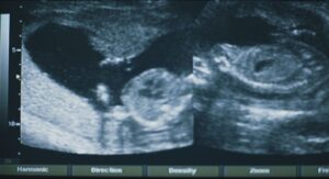 short term 12 cinematography by brett pawlak day establishing shot hard light daylight shot 012